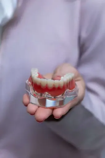 Modelo de prótesis dental sobre implantes en manos de una odontóloga de CECP